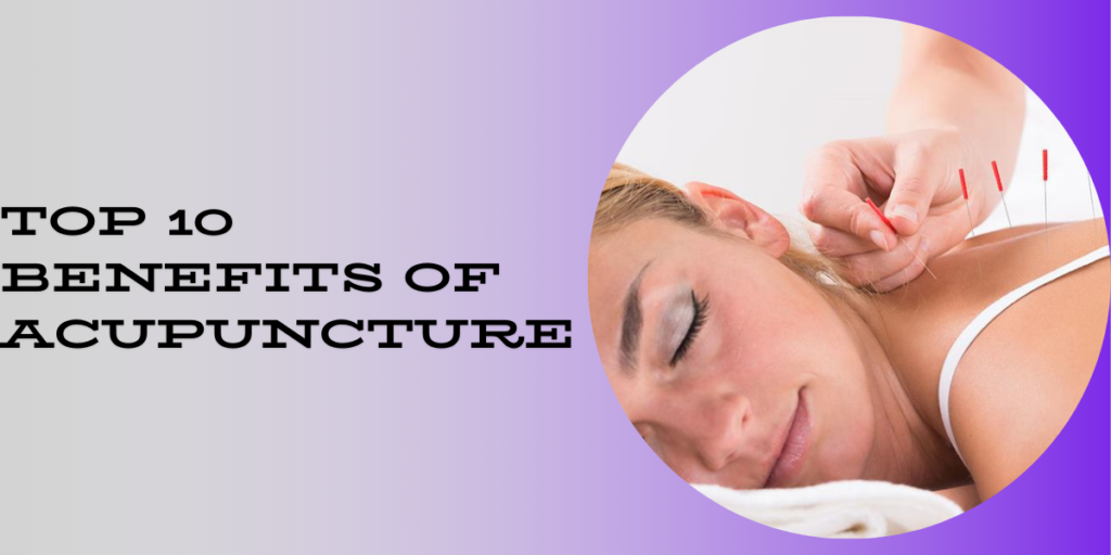 Explore the Top 10 Benefits Of Acupuncture