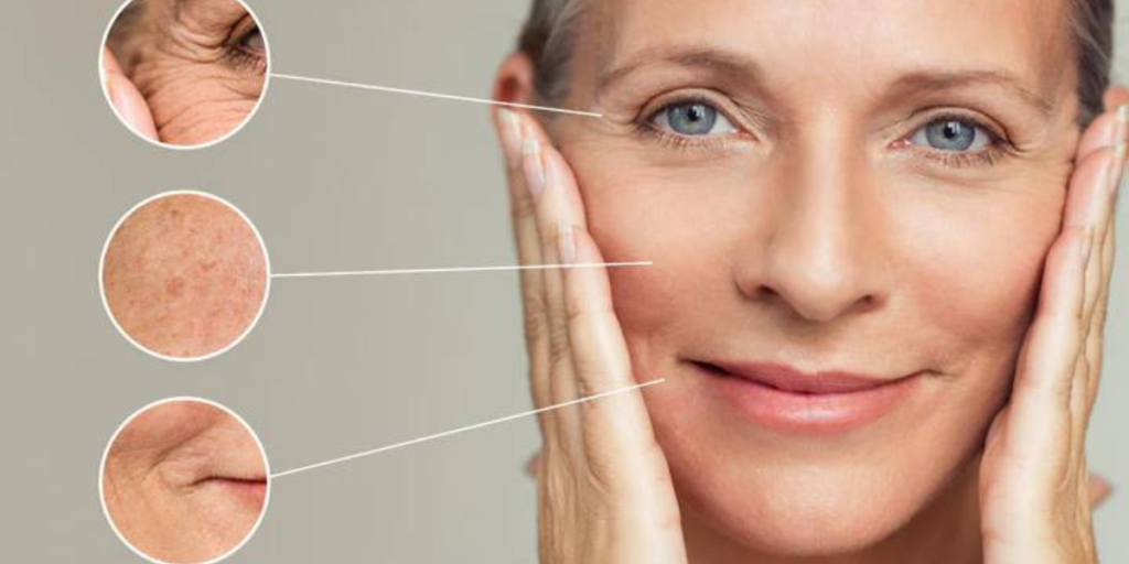 Wrinkles: Types, Causes, Precautions, Treatment, & more!