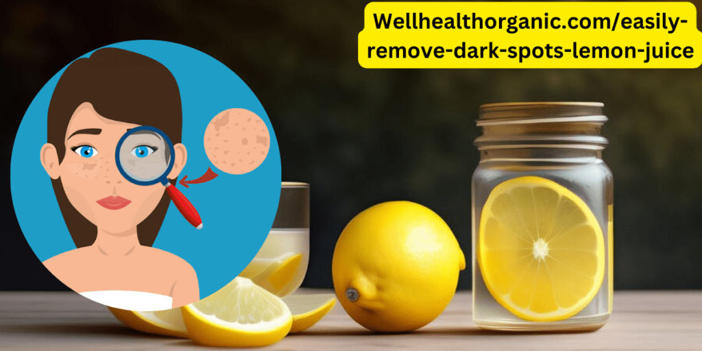 Wellhealthorganic.com/easily-remove-dark-spots-lemon-juice: All Information For You